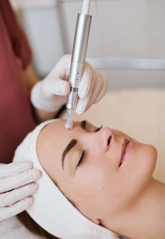 Microneedling mit dem Candela Exceed™