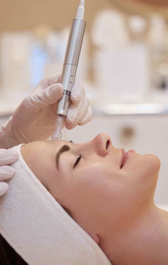 Microneedling